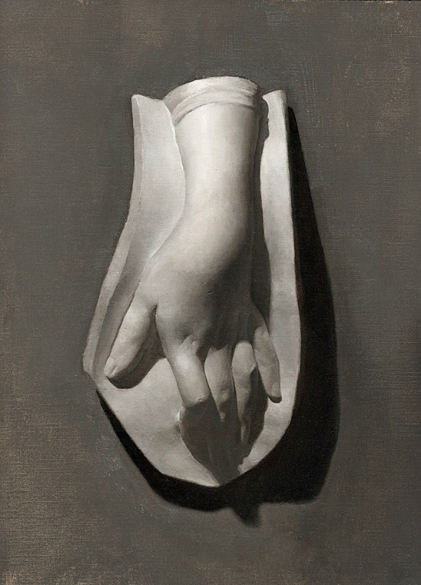 "Гипс, голова, руки и ноги" by Грегори Мартенсон