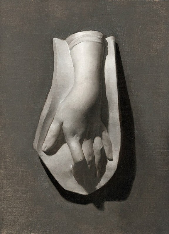 "Гипс, голова, руки и ноги" by Грегори Мартенсон